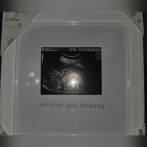 Tiny Ideas White Sonogram Picture Frame